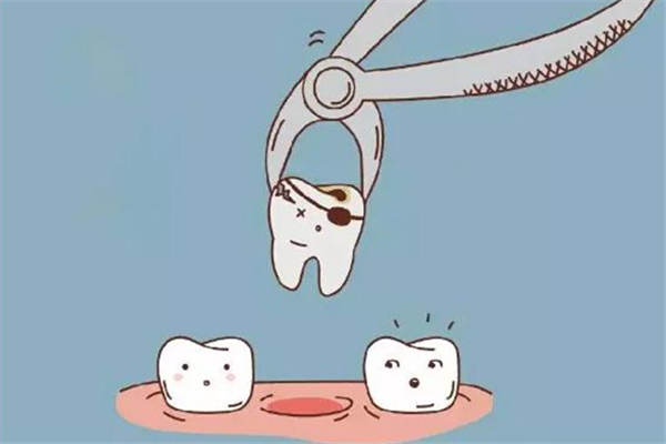 补牙要补几次才能补好 补牙后需要做牙套吗