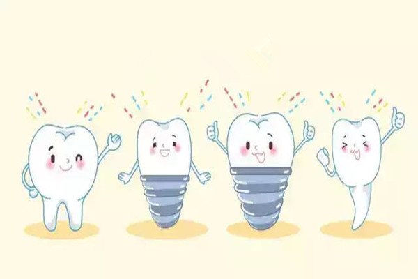 种植牙的寿命是多少年 种植牙贵不贵