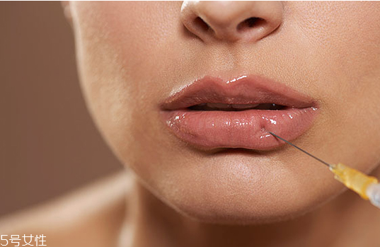 玻尿酸丰唇一周不变软是什么原因 玻尿酸丰唇后要注意