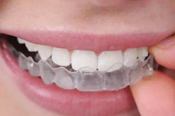 隐形牙套的优缺点 隐形牙套的危害